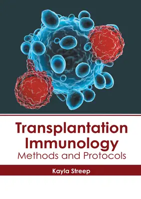 Inmunología de los trasplantes: Métodos y protocolos - Transplantation Immunology: Methods and Protocols