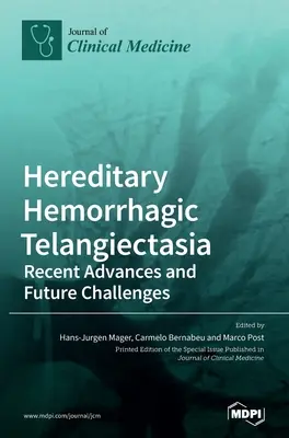 Telangiectasia hemorrágica hereditaria: Avances recientes y retos futuros - Hereditary Hemorrhagic Telangiectasia: Recent Advances and Future Challenges
