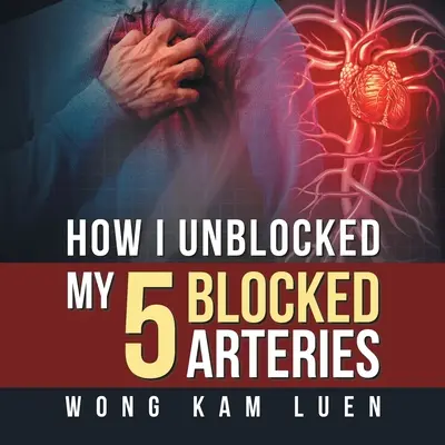 Cómo desbloqueé mis 5 arterias obstruidas - How I Unblocked My 5 Blocked Arteries