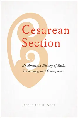 La cesárea: Una historia americana de riesgos, tecnología y consecuencias - Cesarean Section: An American History of Risk, Technology, and Consequence