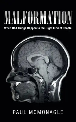 Malformación: Cuando las cosas malas le ocurren a la gente adecuada - Malformation: When Bad Things Happen to the Right Kind of People