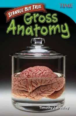 Extraño pero cierto: anatomía macroscópica - Strange but True: Gross Anatomy