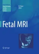 Resonancia magnética fetal - Fetal MRI