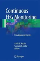 Monitorización electroencefalográfica continua: Principios y práctica - Continuous Eeg Monitoring: Principles and Practice