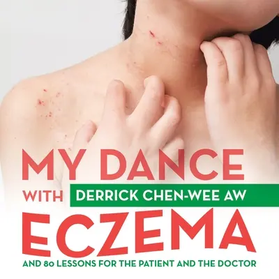 Mi baile con el eczema: Y 80 lecciones para el paciente y el médico - My Dance with Eczema: And 80 Lessons for the Patient and the Doctor