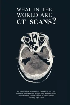 ¿Qué son las tomografías computarizadas? - What in the World are CT Scans?