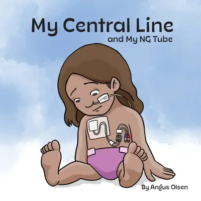 Mi vía central y mi sonda nasogástrica - My Central Line and My NG Tube