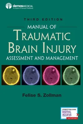 Manual de Daño Cerebral Traumático, Tercera Edición: Evaluación y tratamiento - Manual of Traumatic Brain Injury, Third Edition: Assessment and Management