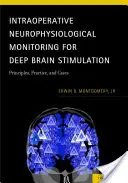 Monitorización neurofisiológica intraoperatoria para la estimulación cerebral profunda: Principios, práctica y casos - Intraoperative Neurophysiological Monitoring for Deep Brain Stimulation: Principles, Practice, and Cases
