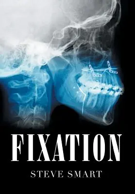 Fijación - Fixation