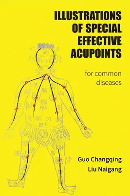 Ilustraciones de puntos de acupuntura especiales eficaces para enfermedades comunes - Illustrations Of Special Effective Acupoints for common Diseases