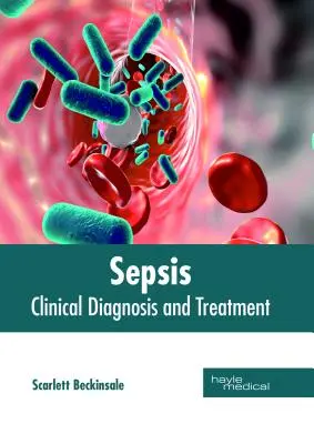 Sepsis: Diagnóstico clínico y tratamiento - Sepsis: Clinical Diagnosis and Treatment