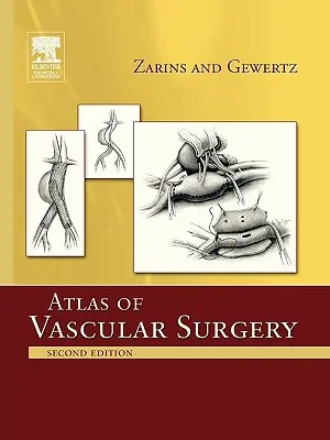 Atlas de cirugía vascular - Edición de bolsillo - Atlas of Vascular Surgery - Paperback Edition