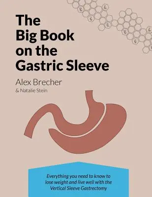 The Big Book on the Gastric Sleeve: Everything You Need to Know to Lose Weight and Live Well with the Vertical Sleeve Gastrectomy (El gran libro de la manga gástrica: Todo lo que necesita saber para perder peso y vivir bien con la gastrectomía vertical en manga) - The Big Book on the Gastric Sleeve: Everything You Need to Know to Lose Weight and Live Well with the Vertical Sleeve Gastrectomy