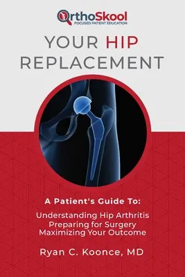 Su prótesis de cadera: Guía para el paciente: Comprender la artritis de cadera, prepararse para la cirugía y maximizar sus resultados - Your Hip Replacement: A Patient's Guide To: Understanding Hip Arthritis, Preparing for Surgery, Maximizing Your Outcome