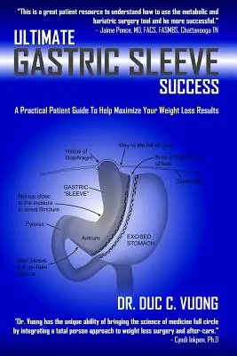 El éxito definitivo de la manga gástrica: Una guía práctica para el paciente que le ayudará a maximizar sus resultados de pérdida de peso - Ultimate Gastric Sleeve Success: A Practical Patient Guide To Help Maximize Your Weight Loss Results