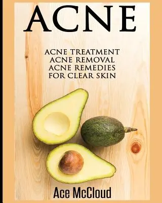 Acné: Tratamiento del acné: Eliminación del acné: Remedios para el acné - Acne: Acne Treatment: Acne Removal: Acne Remedies For Clear Skin