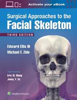 Abordajes quirúrgicos del esqueleto facial - Surgical Approaches to the Facial Skeleton