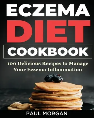 Eczema DIet Cookbook: 100 Deliciosas Recetas para Controlar la Inflamación de tu Eczema - Eczema DIet Cookbook: 100 Delicious Recipes to Manage your Eczema Inflammation