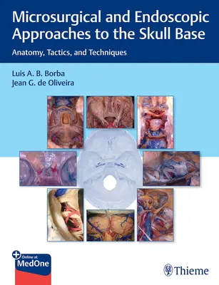 Abordajes microquirúrgicos y endoscópicos de la base del cráneo: Anatomía, Tácticas y Técnicas - Microsurgical and Endoscopic Approaches to the Skull Base: Anatomy, Tactics, and Techniques