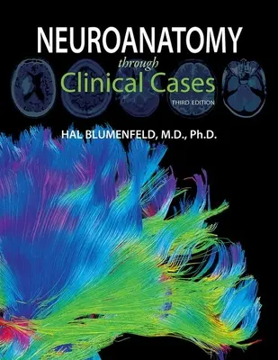 Neuroanatomía a través de casos clínicos - Neuroanatomy Through Clinical Cases