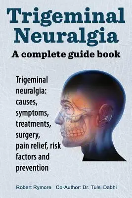 Neuralgia del trigémino: libro guía completo. Neuralgia del trigémino: causas, síntomas, tratamientos, cirugía, - Trigeminal neuralgia: a complete guide book. Trigeminal neuralgia: causes, symptoms, treatments, surgery,
