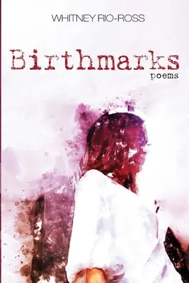 Marcas de nacimiento - Birthmarks