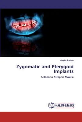 Implantes cigomáticos y pterigoideos - Zygomatic and Pterygoid Implants