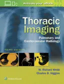 Imagen Torácica: Radiología Pulmonar y Cardiovascular - Thoracic Imaging: Pulmonary and Cardiovascular Radiology