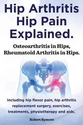Artritis de Cadera, Dolor de Cadera Explicado. La osteoartritis en las caderas, la artritis reumatoide en las caderas. Incluyendo la cirugía de la artritis de cadera, dolor flexor de la cadera, ejercicios, - Hip Arthritis, Hip Pain Explained. Osteoarthritis in Hips, Rheumatoid Arthritis in Hips. Including Hip Arthritis Surgery, Hip Flexor Pain, Exercises,