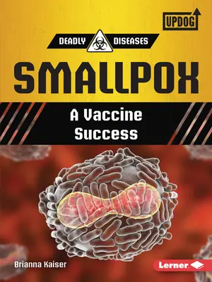 La viruela: El éxito de una vacuna - Smallpox: A Vaccine Success