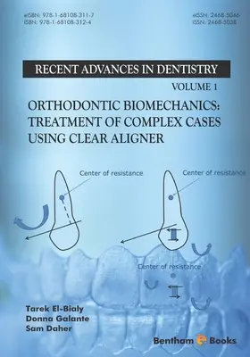 Biomecánica ortodóncica: Tratamiento de casos complejos con Clear Aligner - Orthodontic Biomechanics: Treatment Of Complex Cases Using Clear Aligner