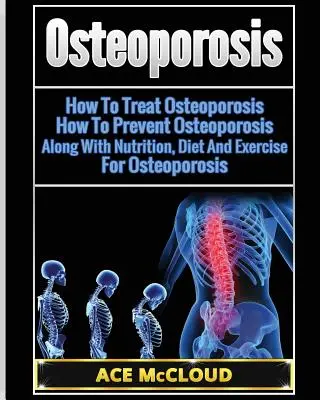 Osteoporosis: Cómo tratar la osteoporosis: Cómo prevenir la osteoporosis: Junto Con Nutrición, Dieta Y Ejercicio Para La Osteoporosis - Osteoporosis: How To Treat Osteoporosis: How To Prevent Osteoporosis: Along With Nutrition, Diet And Exercise For Osteoporosis