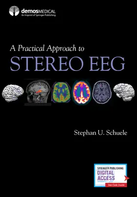 Un enfoque práctico del EEG estereoscópico - A Practical Approach to Stereo Eeg