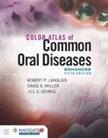 Atlas en color de enfermedades orales comunes, edición mejorada - Color Atlas of Common Oral Diseases, Enhanced Edition