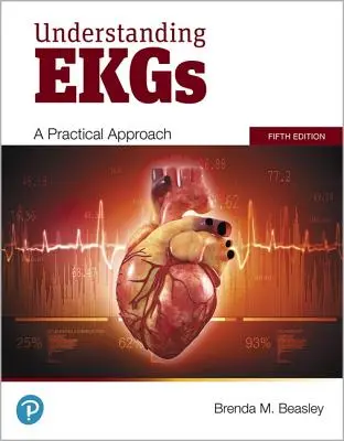 Comprender los electrocardiogramas: un enfoque práctico - Understanding EKGs: A Practical Approach