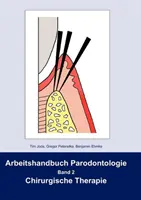 Arbeitshandbuch Parodontologie: Band 2 Chirurgische Therapie