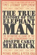 La verdadera historia del hombre elefante - True History of the Elephant Man