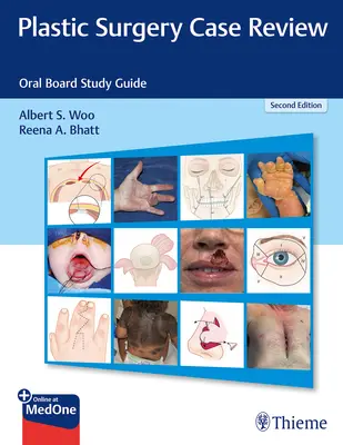 Revisión de casos de cirugía plástica: Oral Board Study Guide - Plastic Surgery Case Review: Oral Board Study Guide