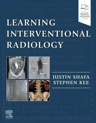Aprendizaje de Radiología Intervencionista - Learning Interventional Radiology