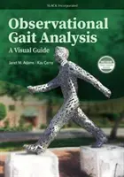 Análisis observacional de la marcha: Una guía visual - Observational Gait Analysis: A Visual Guide