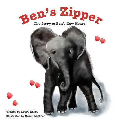 La cremallera de Ben: La historia del nuevo corazón de Ben - Ben's Zipper: The Story of Ben's New Heart