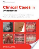 Casos clínicos de ortodoncia - Clinical Cases in Orthodontics