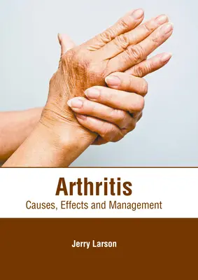 Artritis: Causas, efectos y tratamiento - Arthritis: Causes, Effects and Management