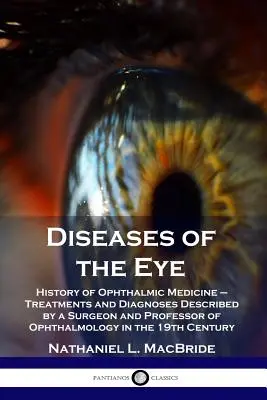 Enfermedades del Ojo: Historia de la Medicina Oftálmica - Tratamientos y Diagnósticos Descritos por un Cirujano y Profesor de Oftalmología en el - Diseases of the Eye: History of Ophthalmic Medicine - Treatments and Diagnoses Described by a Surgeon and Professor of Ophthalmology in the