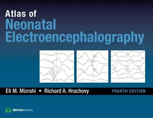 Atlas de electroencefalografía neonatal - Atlas of Neonatal Electroencephalography