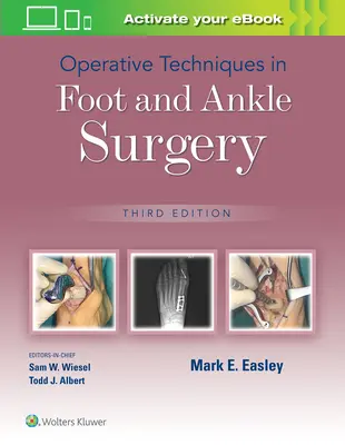 Técnicas operatorias en cirugía de pie y tobillo - Operative Techniques in Foot and Ankle Surgery