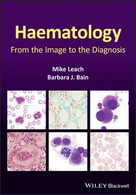 Hematología: De la imagen al diagnóstico - Haematology: From the Image to the Diagnosis