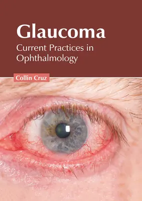 Glaucoma: Prácticas actuales en oftalmología - Glaucoma: Current Practices in Ophthalmology