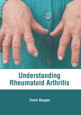 Entender la artritis reumatoide - Understanding Rheumatoid Arthritis